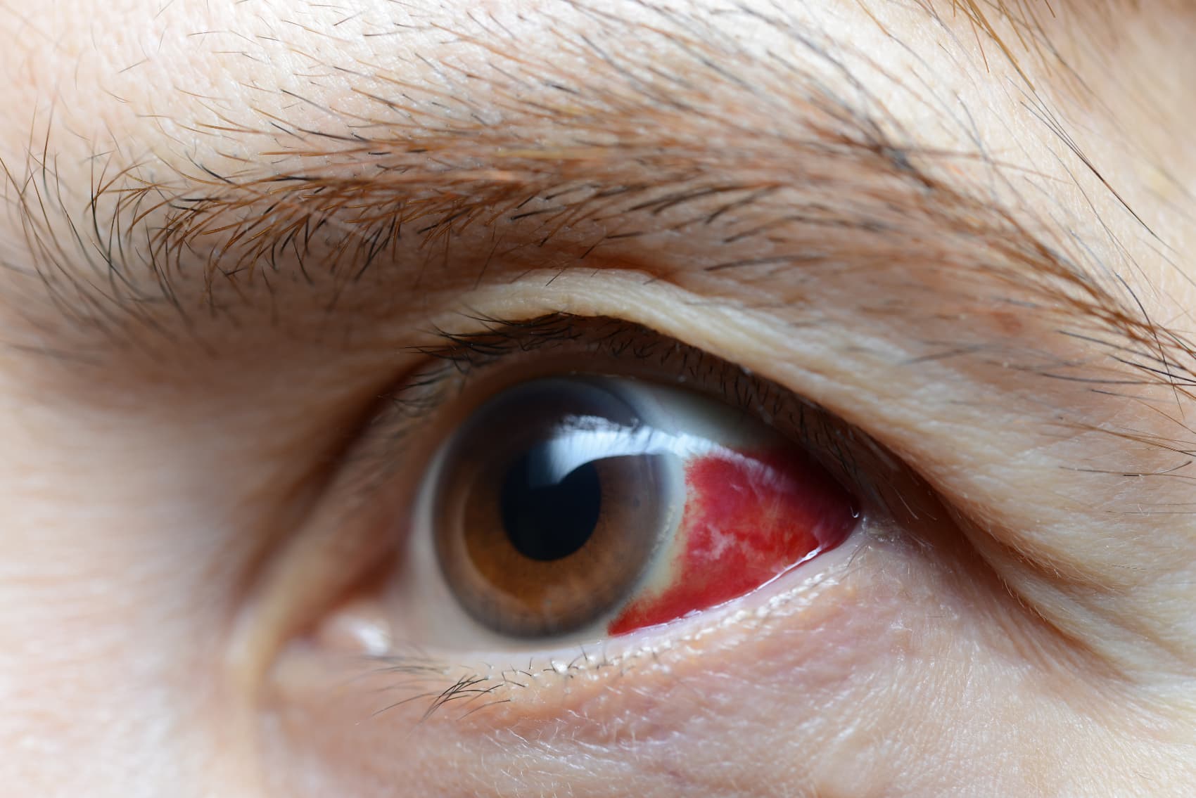 Symptoms after eye injection | Dr Brian Ang